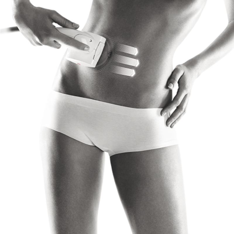 LPG WELLBOX S - myernk